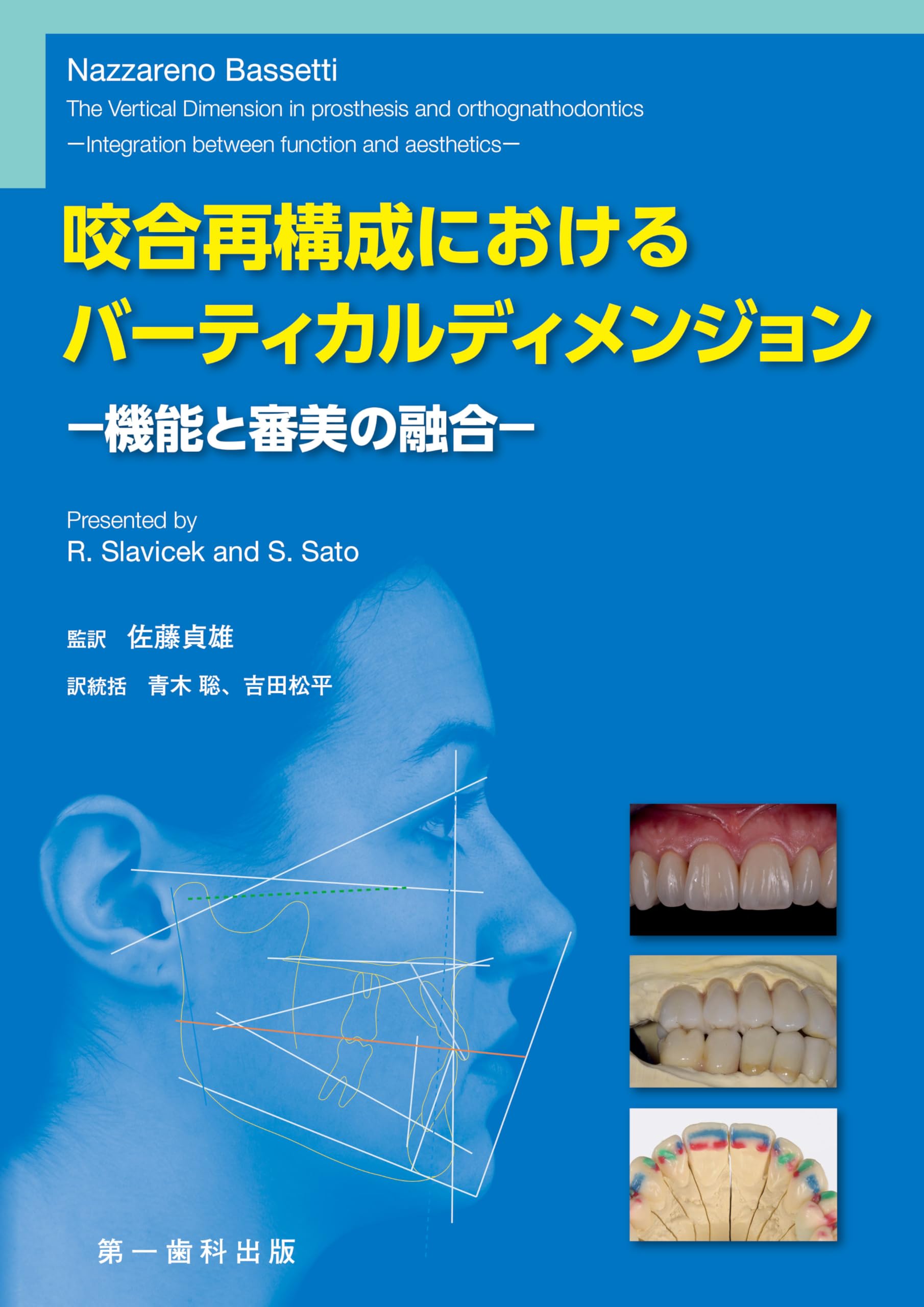 咬合再構成におけるバーティカルディメンジョン ー機能と審美の融合ー