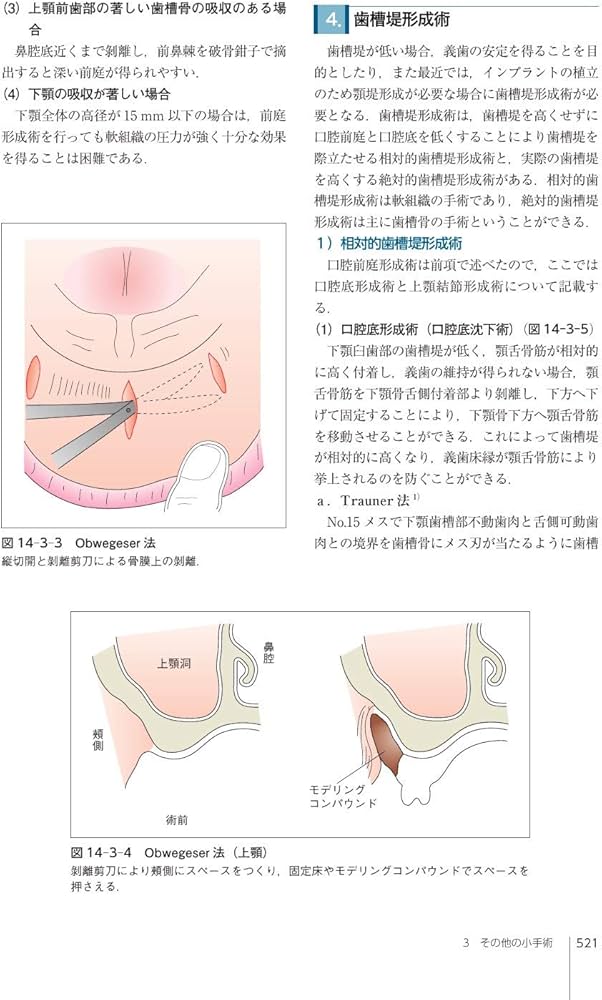 口腔外科学 第4版 | 白砂 兼光, 古郷 幹彦 |本 | 通販 | Amazon