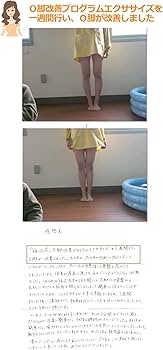 Amazon.co.jp: O脚の治し方、即効性ある簡単ストレッチ5分だけ O脚矯正