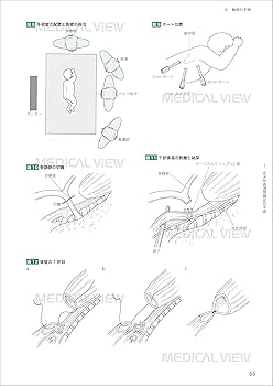必修 小児外科手術［Web動画付］ | 奥山 宏臣, 内田 広夫, 小野 滋, 家