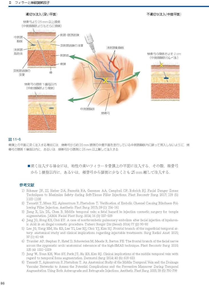Facial Danger Zones 日本語版（フェイシャルデンジャーゾーン）［Web