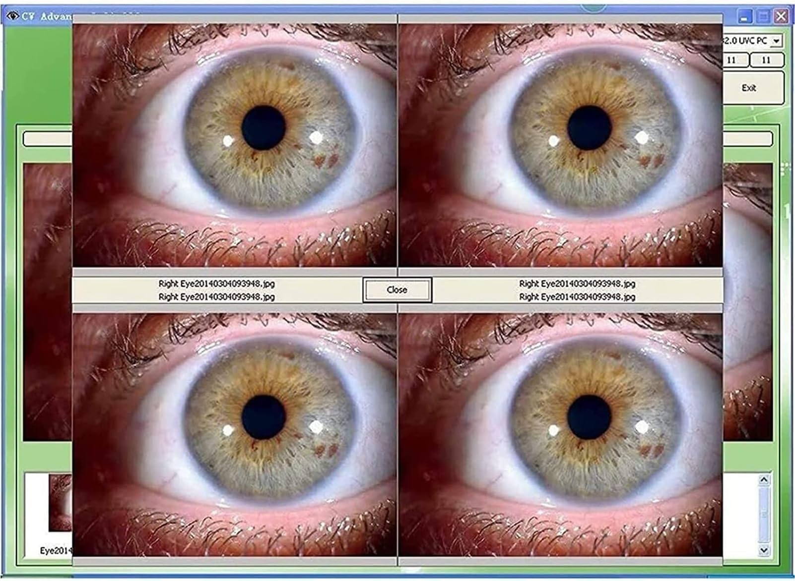 Amazon.co.jp: 自動虹彩検出器虹彩分析カメラ、HD 130万ピクセル虹彩