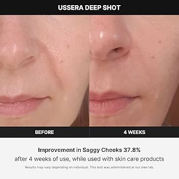 Medicube Age-R USSERA Facial Treatment Device - at-Home Skin Care