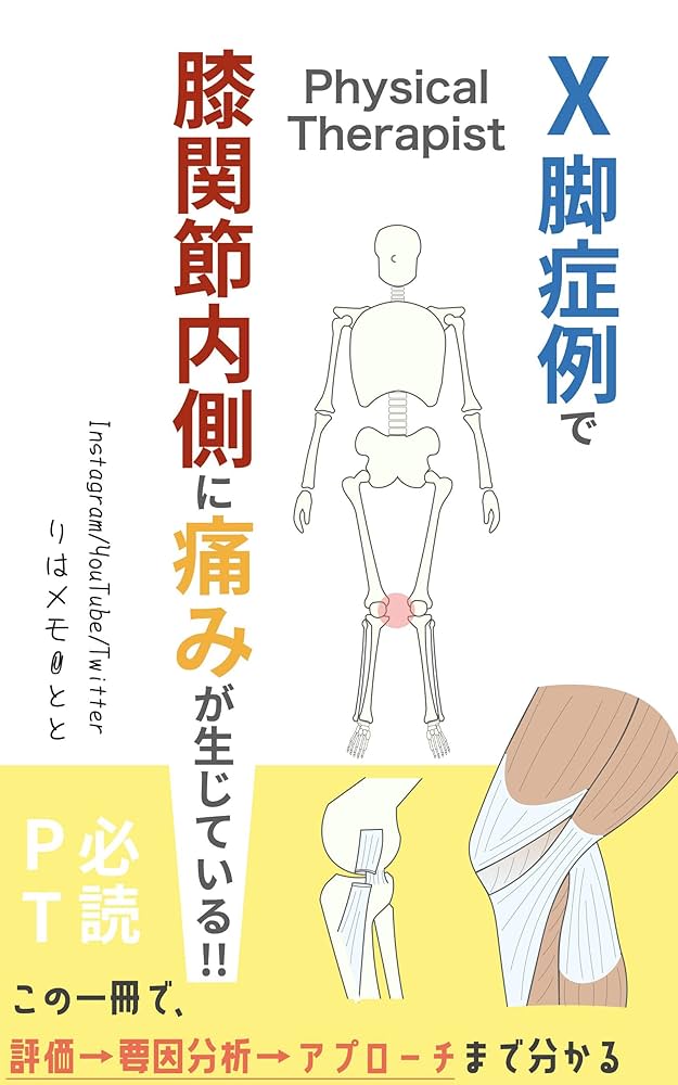 X脚変形」膝関節内側の痛みに対する理学療法【しっかり解説】 リハメモ