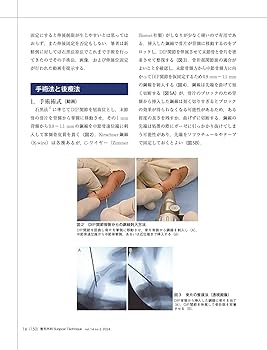 整形外科サージカルテクニック 2024年2号〈特集〉手部・指節骨骨折