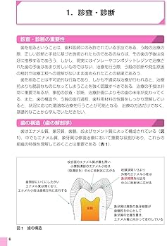 Amazon.co.jp: 歯科臨床まずはここから! う蝕処置: 卒後5年を支える