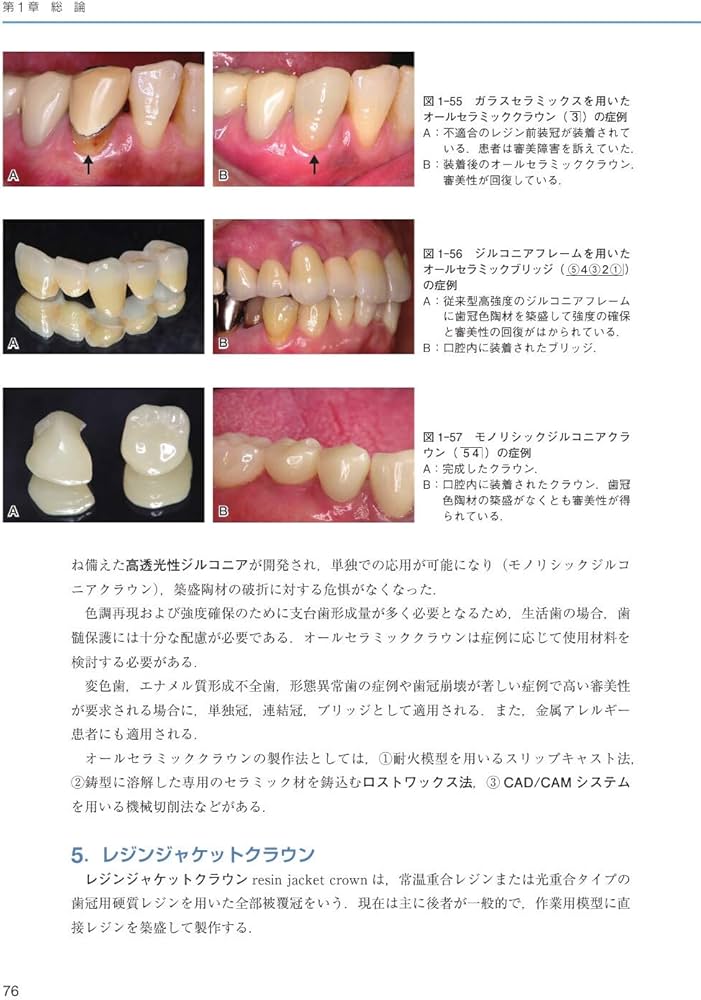 クラウンブリッジ補綴学第6版 | 矢谷 博文, 三浦 宏之, 細川 隆司