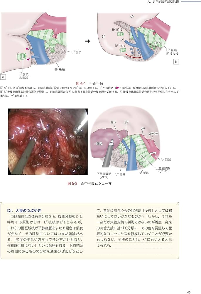 71JB4F4p06L._AC_UF1000,