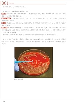 71JBvZqonRL._AC_UF350,