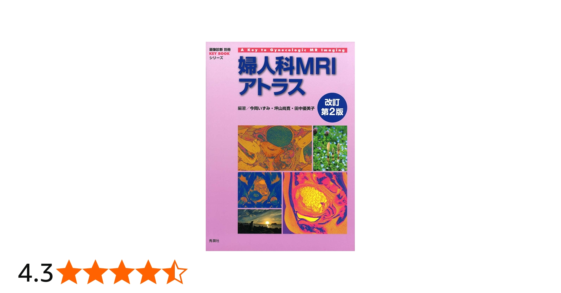 婦人科MRIアトラス 改訂第2版 (画像診断 別冊KEYBOOKシリーズ) | 今岡