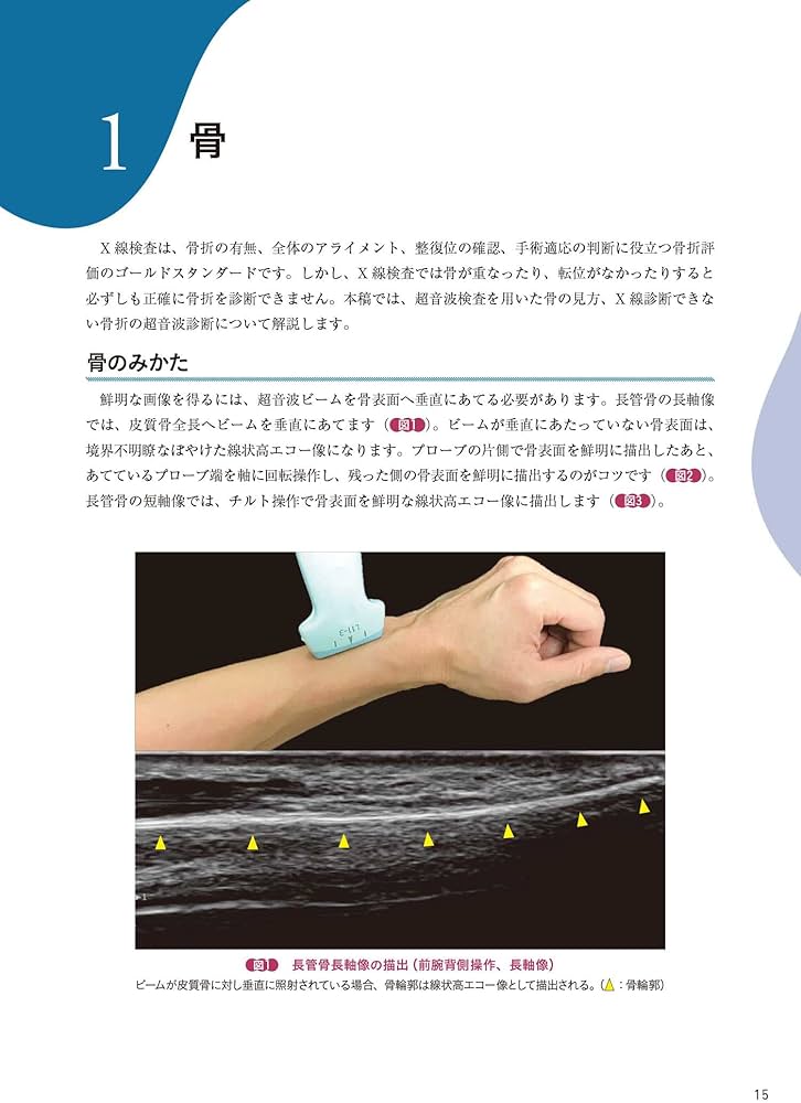 Amazon.co.jp: 運動器エコーのメタ診療: 実臨床に役立つAR動画100本