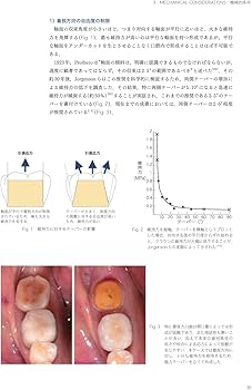 THINK SCIENTIFIC TOOTH PREPARATION 頭で削る支台歯形成 | 錦織 淳