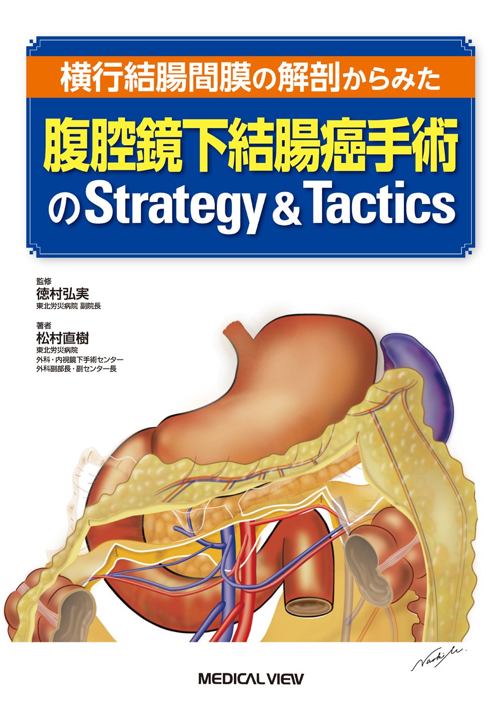 横行結腸間膜の解剖からみた 腹腔鏡下結腸癌手術のStrategy & Tactics