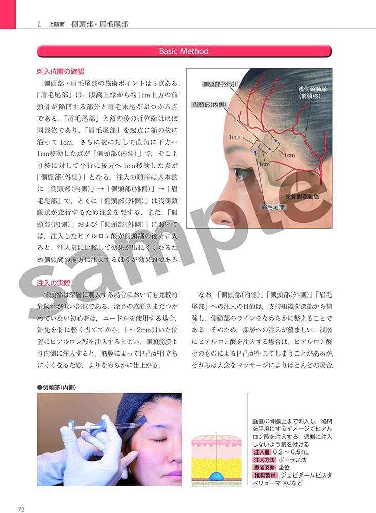 Amazon.co.jp: 解剖から学ぶ ヒアルロン酸注入療法 : 古山登隆, 古山登