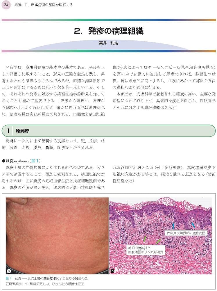 1冊でわかる皮膚病理 第2版 (皮膚科サブスペシャリティーシリーズ