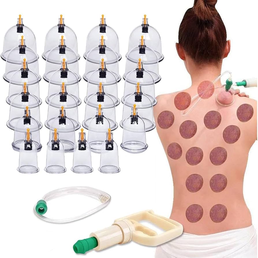 Amazon.co.jp: 24個のカッピングセラピーセット、プロの中国カッピング