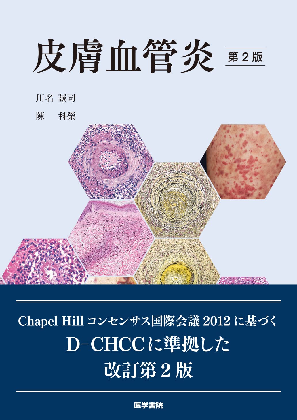 Amazon.co.jp: 皮膚血管炎 第2版 : 川名 誠司, 陳 科榮: 本