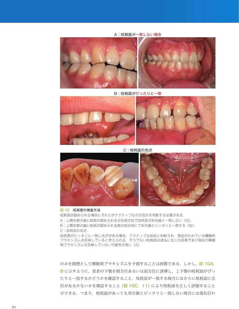 ブラキシズム完全読本 | 馬場 一美, 西山 暁, 宮脇 正一, 馬場 一美
