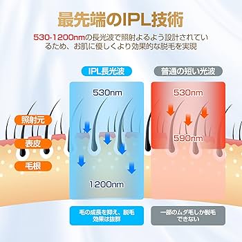 Amazon | Donamo 脱毛器【サロン級IPL光脱毛器/低刺激でVIO対応】髭