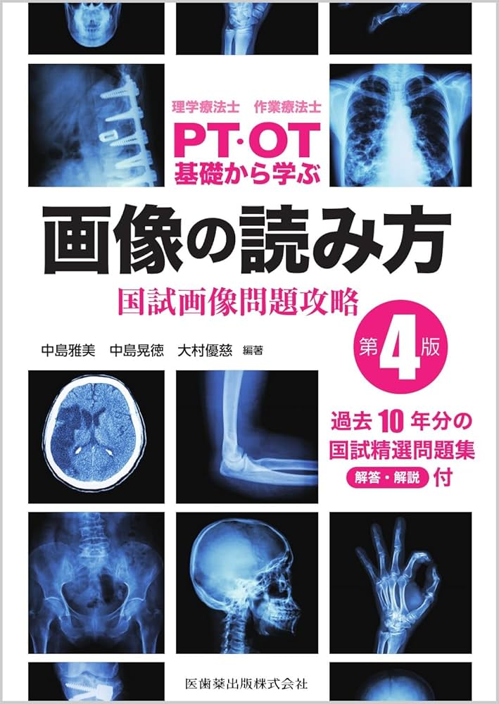 理学療法士・作業療法士 PT・OT基礎から学ぶ画像の読み方第4版 国試