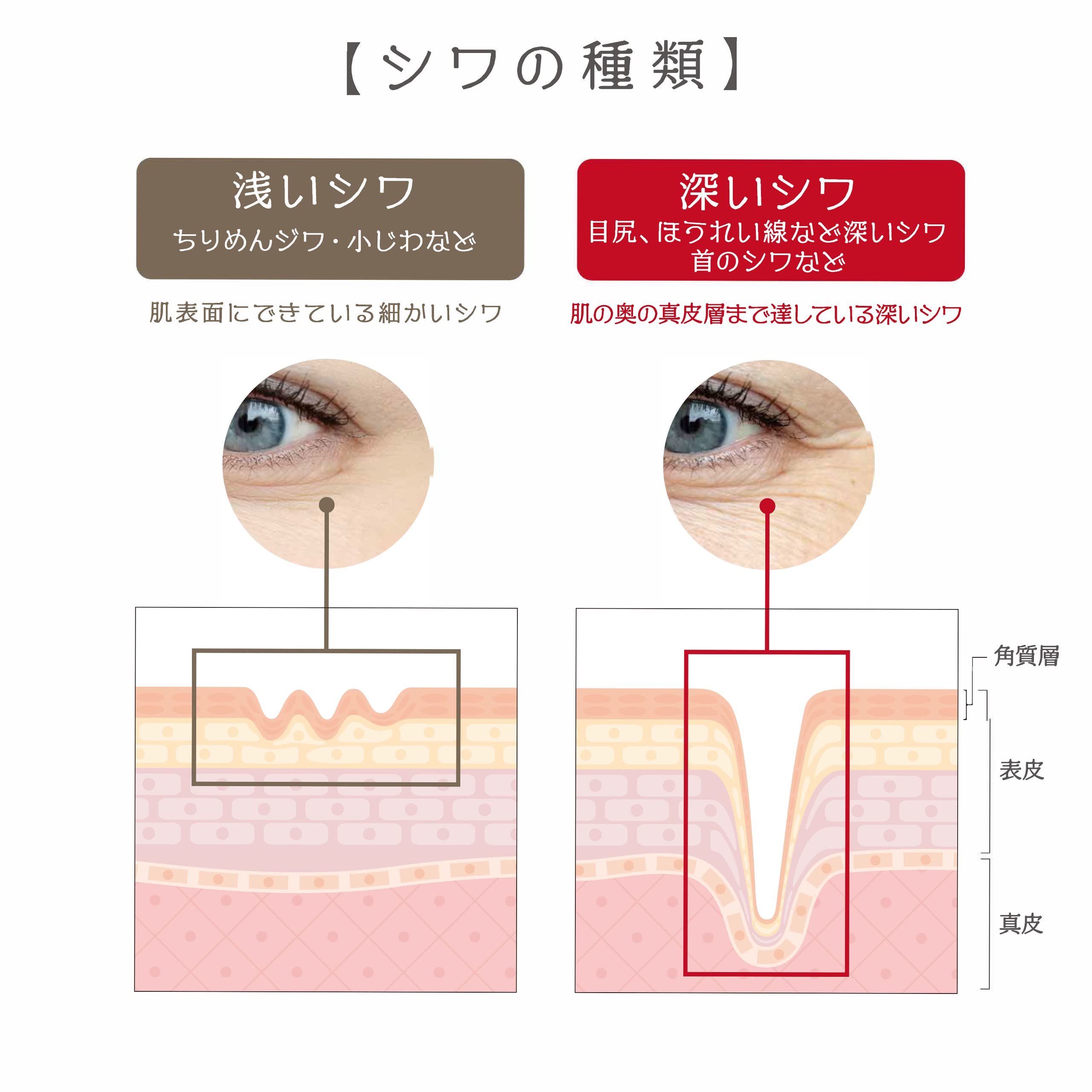 Amazon.co.jp: PESCA (ペスカ) 【 薬用リンクルホワイトゲル