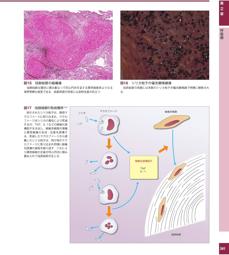 解明病理学第4版 病気のメカニズムを解く | 青笹 克之, 加藤 光保