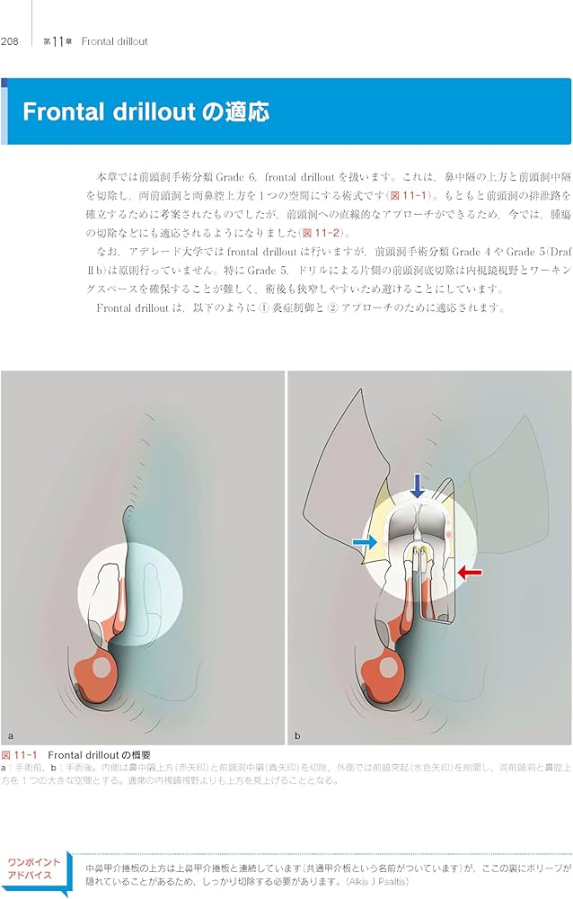 Amazon.co.jp: ウォーモルド直伝 内視鏡下鼻副鼻腔手術トレーニング