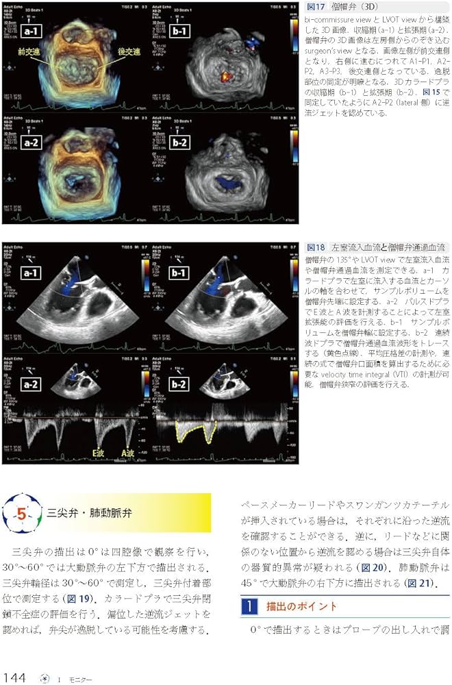理解して使いこなす麻酔科機器 (麻酔科プラクティス 9): モニター・ICU