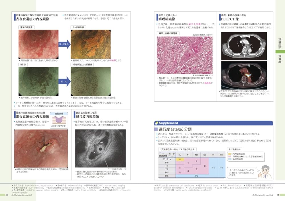 病気がみえる 〈vol.1〉 消化器 | 医療情報科学研究所 |本 | 通販 | Amazon