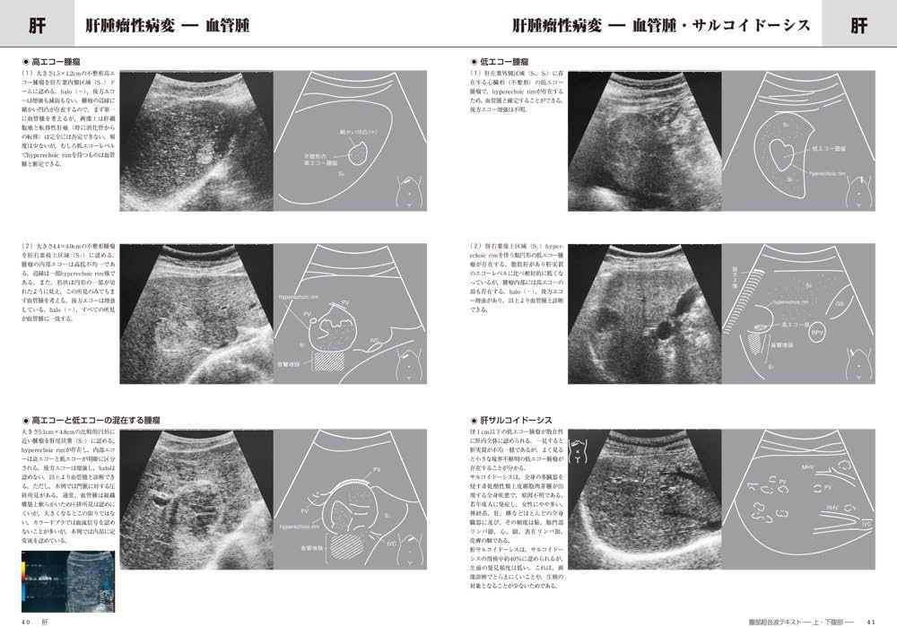 腹部超音波テキスト〜上・下腹部〜 改訂第三版 (Atlas Series超音波編