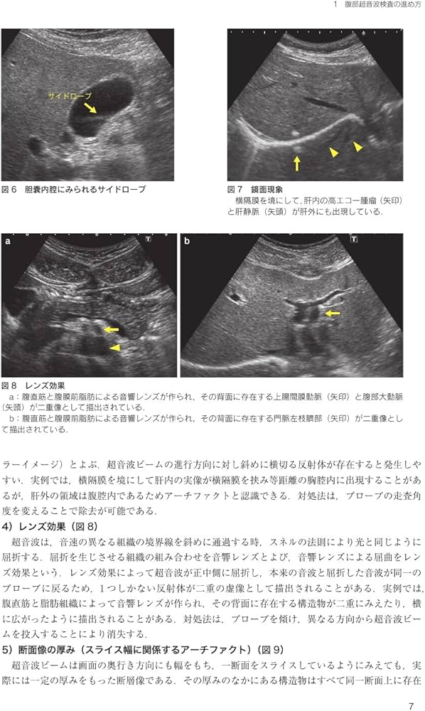 日超検 腹部超音波テキスト第3版 | 日本超音波検査学会, 南里 和秀