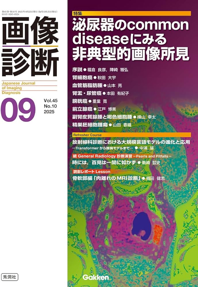 画像診断2025年9月号 Vol.45 No.10: 泌尿器のCommon diseaseにみる非典