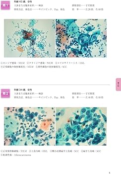 細胞検査士細胞像試験問題集 第2版 | 公益社団法人日本臨床細胞学会