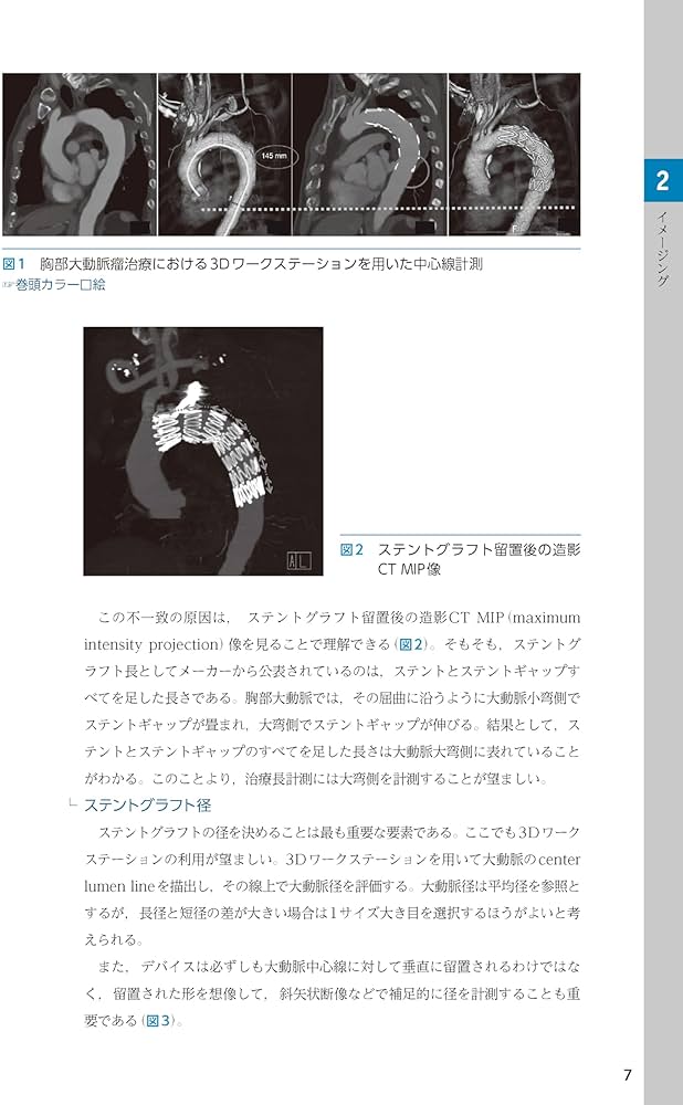 ステントグラフト内挿術マニュアル 胸部編 ─ 動画を含む電子版付
