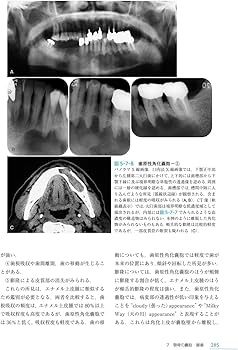 歯科放射線学 第7版 | 岡野 友宏, 小林 馨, 有地 榮一郎, 勝又 明敏