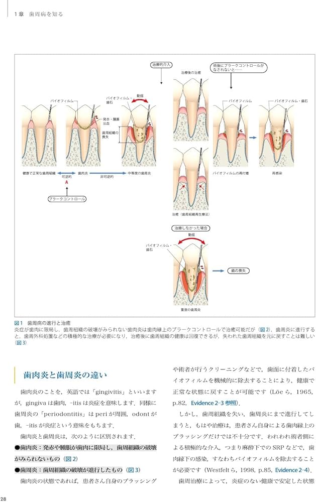 Dr.弘岡に訊く臨床的ペリオ講座 スカンジナビアンアプローチの実践