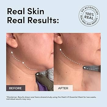 Amazon.com: Essential Mask - Medi Lift EMS Facial Toning Device