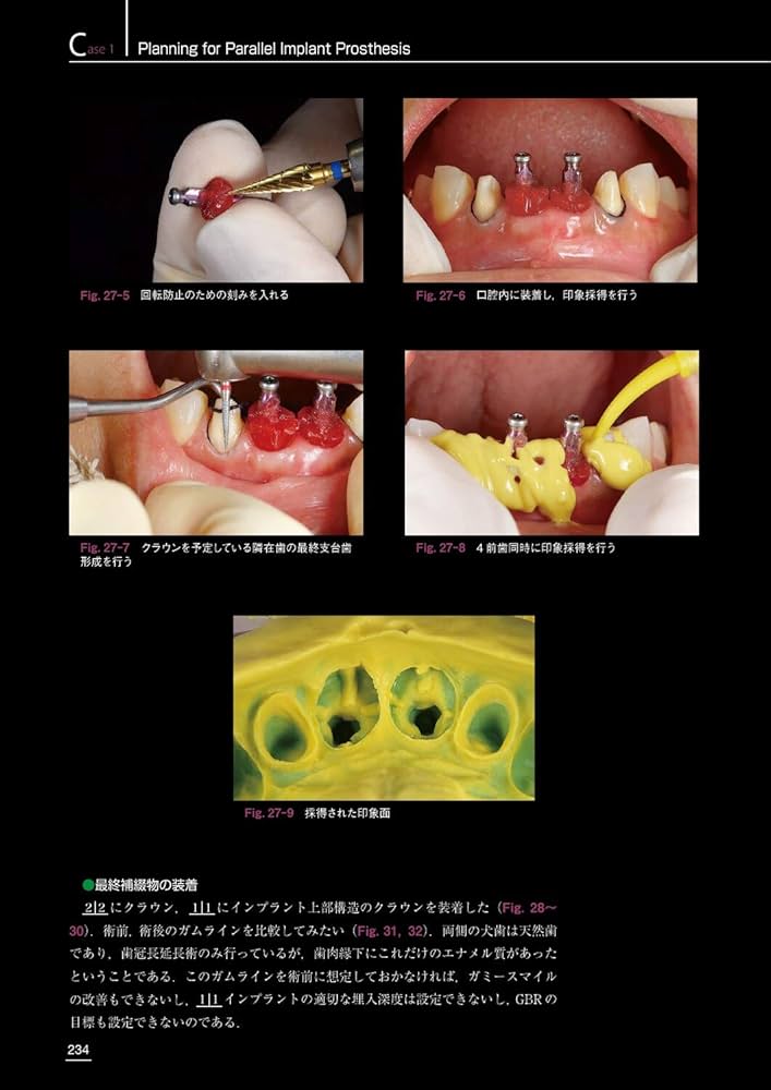包括的治療戦略 Vol.2 for Functional Management | 土屋 賢司 |本
