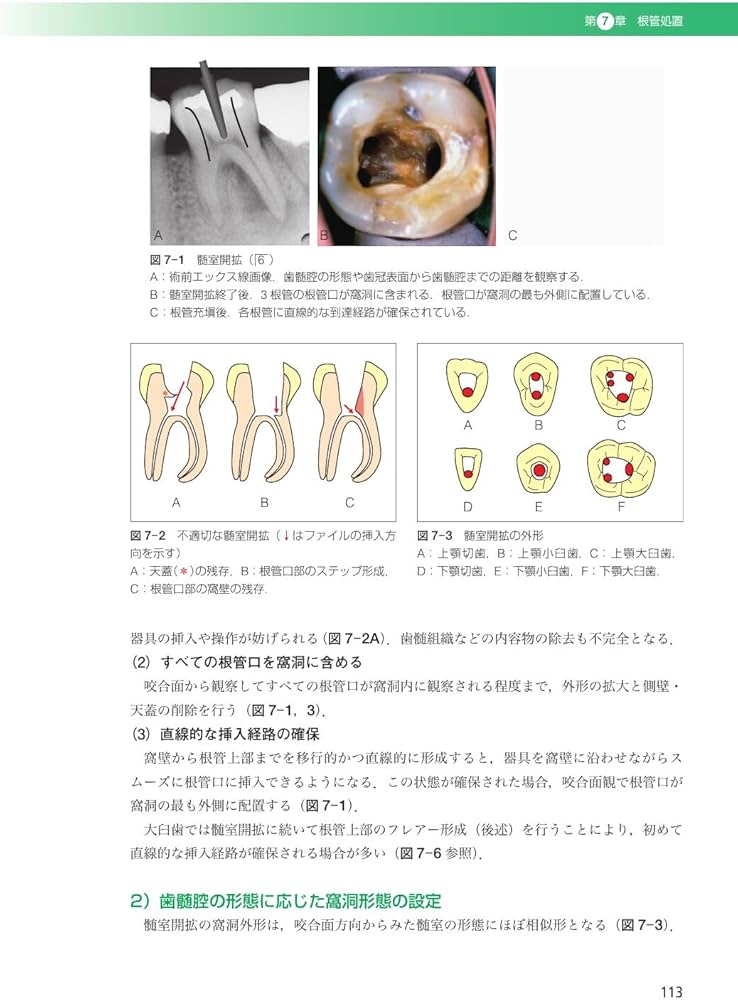 歯内治療学 第6版 | 興地 隆史, 石井 信之, 前田 英史, 鈴木 規元 |本
