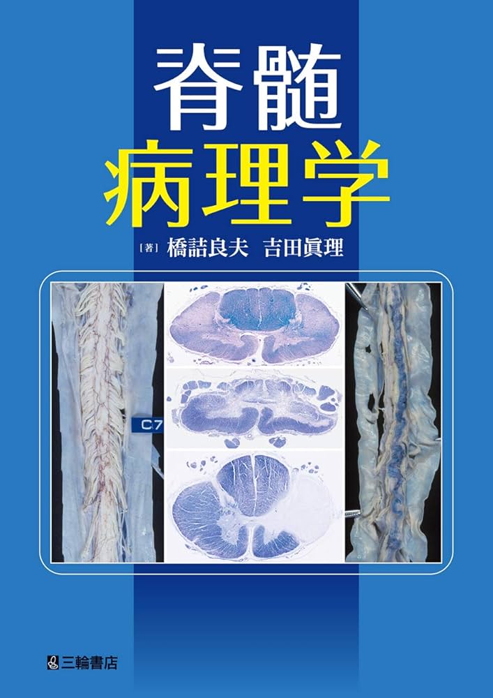 脊髄病理学 | 橋詰 良夫, 吉田 眞理 |本 | 通販 | Amazon