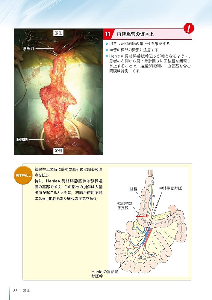 内視鏡外科消化器再建術のすべて | 阿部展次, 上野正紀, 江原一尚