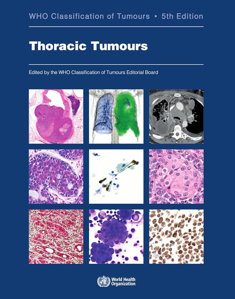Thoracic Tumours: WHO Classification of Tumours: 9789283245063