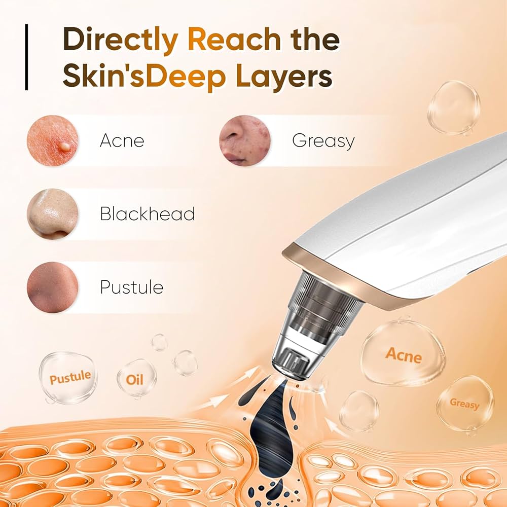 Blackhead Remover Vacuum - Professional Blackhead Extractor for