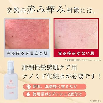 Amazon | 突然の赤み痒みに クレチュール ジュレローションEX ナノミド