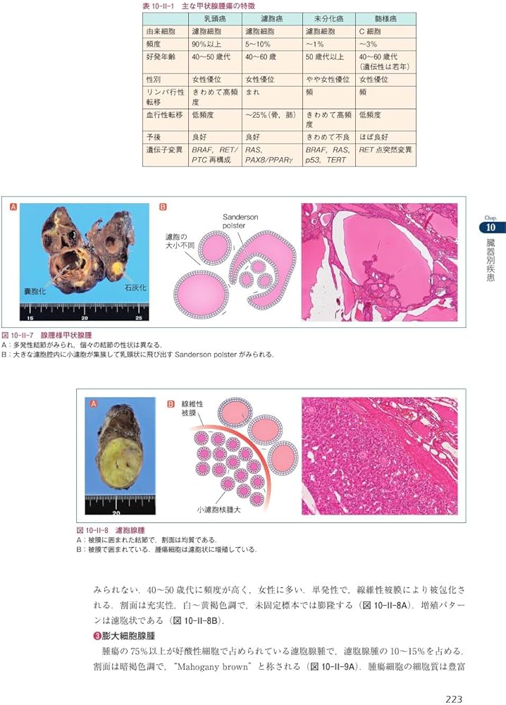 歯学生のための基礎病理学 | 髙田 隆, 豊澤 悟, 田沼 順一, 岡田 康男
