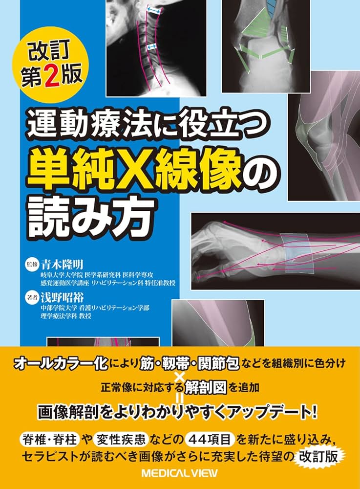 運動療法に役立つ単純X線像の読み方−改訂第2版 | 青木 隆明, 浅野