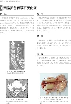 脊椎・脊髄疾患の外科 第2版 | 飛驒一利, 小柳 泉 |本 | 通販 | Amazon