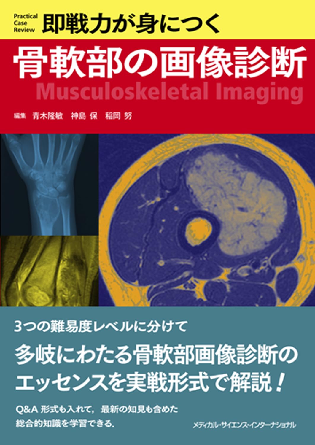 即戦力が身につく骨軟部の画像診断 | 青木隆敏, 神島 保, 稲岡 努 |本