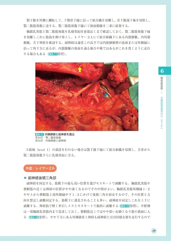 頭頸部がん手術ノート 輪層の外科 | 長谷川 泰久 |本 | 通販 | Amazon