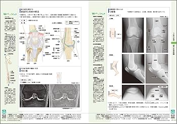 病気がみえる vol.11 運動器・整形外科 第2版 | 医療情報科学研究所